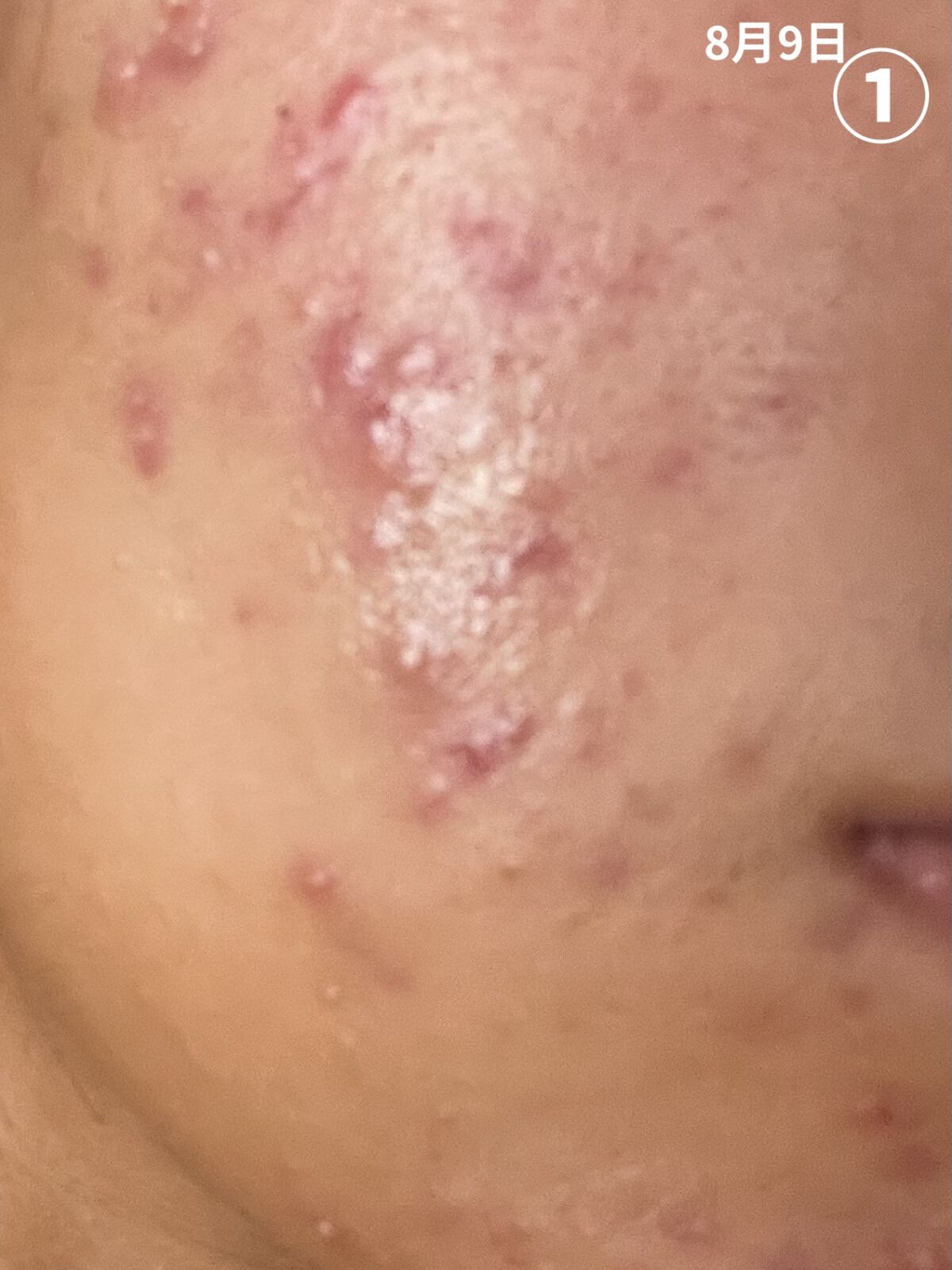 ハイドロクリームPHQ-8/KISO/美容液を使ったクチコミ（2枚目）