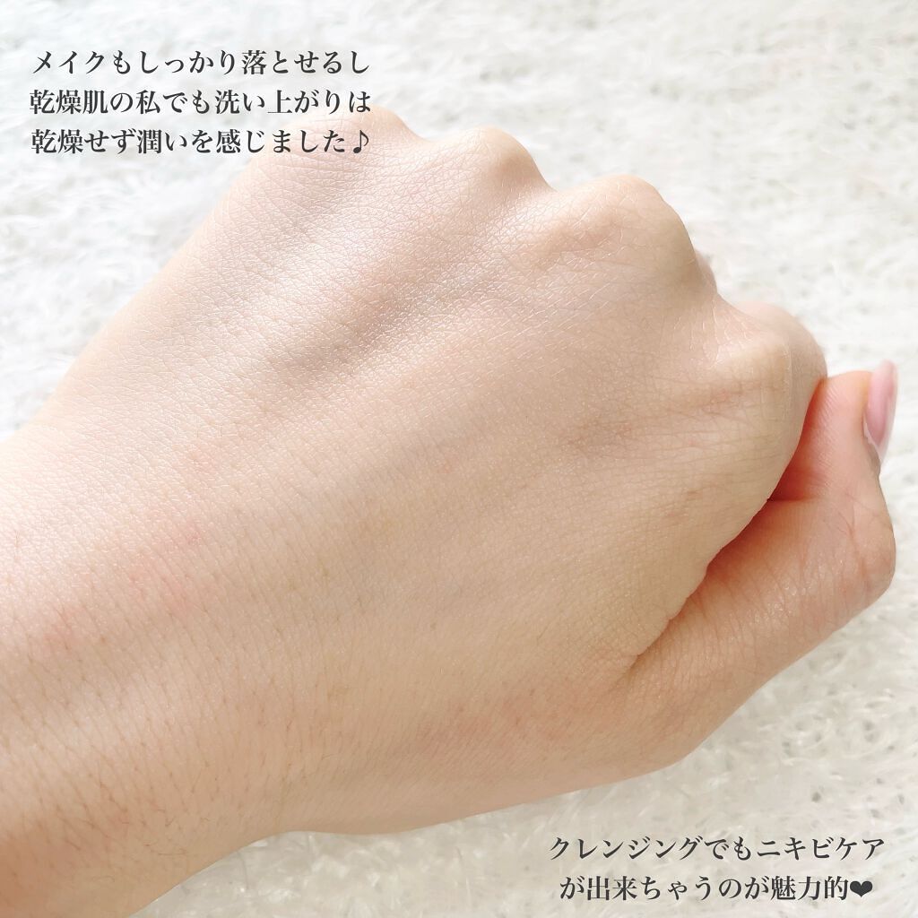 ティーツリーカーミングクレンジングバーム/MEDIHEAL/クレンジングバームを使ったクチコミ(7枚目)