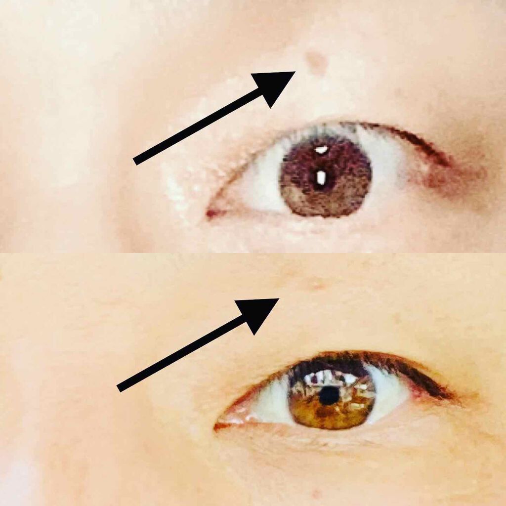 エクストラダブルホワイト美容原液Eタイプ/PlusRay/ブースター・導入液を使ったクチコミ（3枚目）