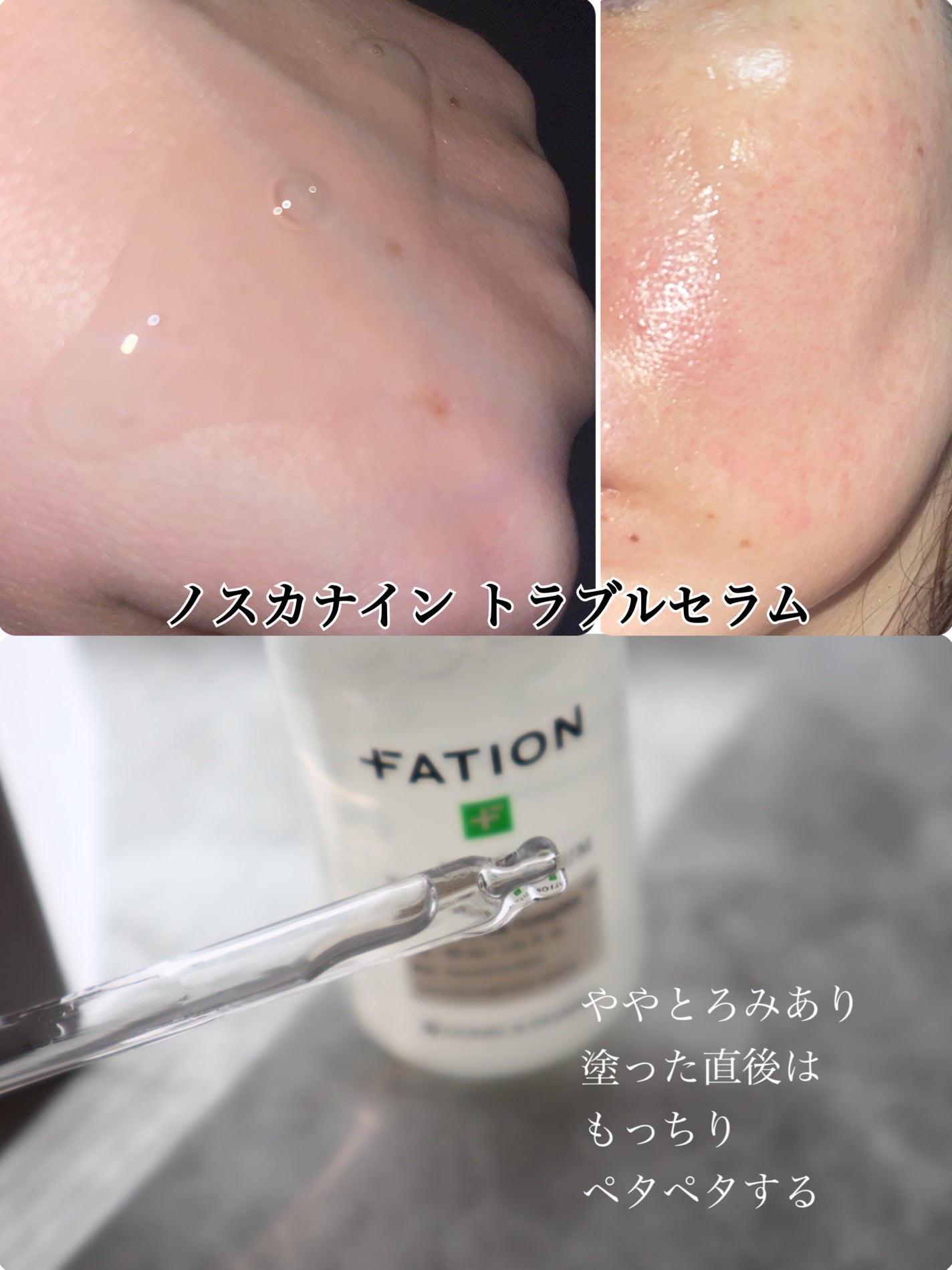 ノスカナイン トラブル セラム/FATION/美容液を使ったクチコミ(3枚目)