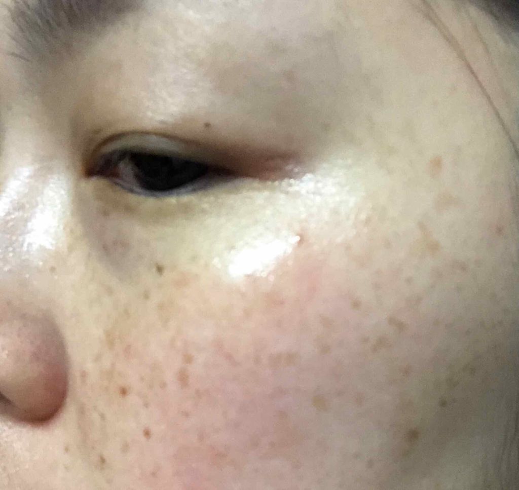 ホワイト 薬用ドットゼロ/リッツ/美容液を使ったクチコミ（2枚目）