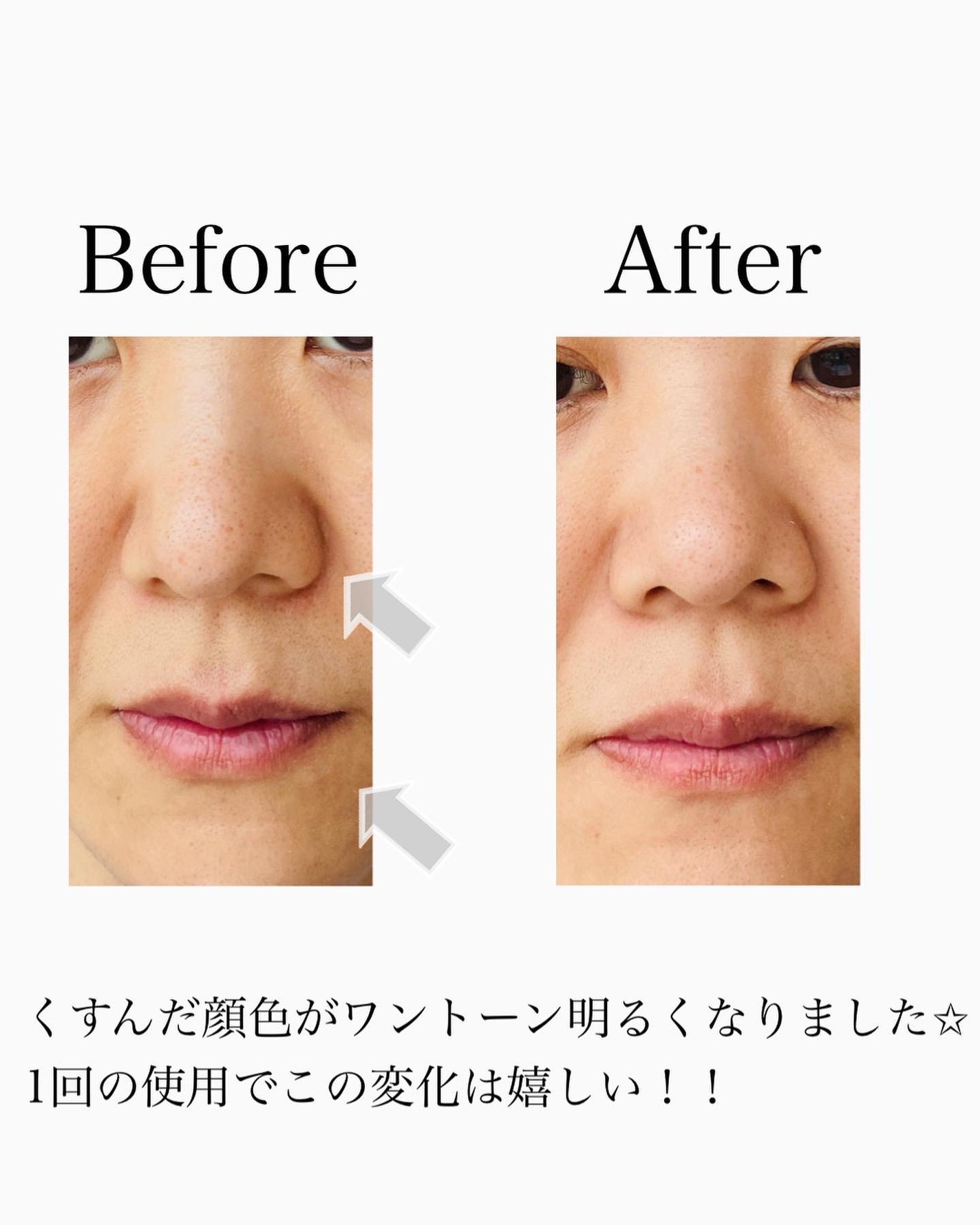 ロゼットゴマージュ/ロゼット/ピーリングを使ったクチコミ(6枚目)