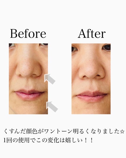 ロゼットゴマージュ/ロゼット/ピーリングを使ったクチコミ(6枚目)