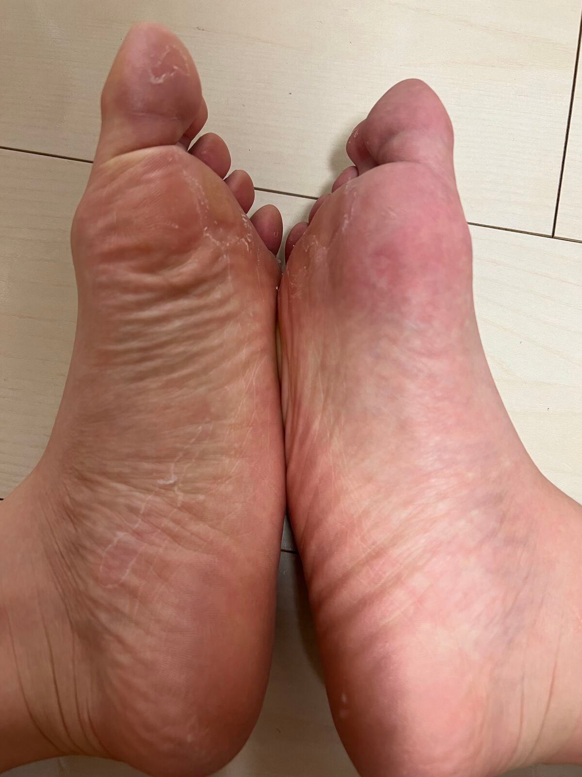 足裏角質パック グレープフルーツの香り/EVERYYOU/レッグ・フットケアを使ったクチコミ(3枚目)