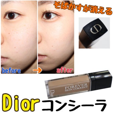 【旧】ディオールスキン フォーエヴァー スキン コレクト コンシーラー/Dior/コンシーラーを使ったクチコミ（1枚目）