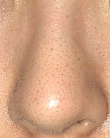 化粧水・敏感肌用・しっとりタイプ/無印良品/化粧水を使ったクチコミ(4枚目)