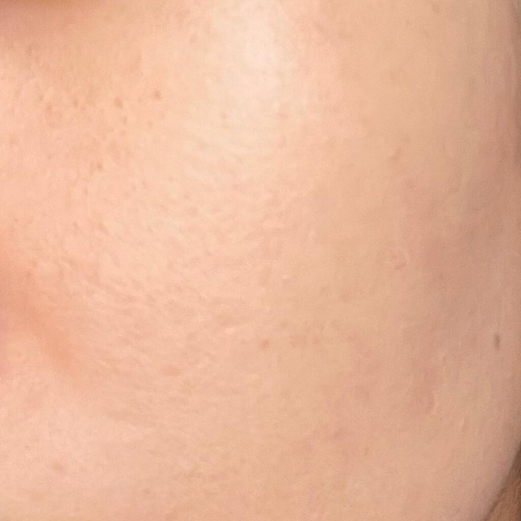 ウルトラスリムクッション+レフィルセット/APRILSKIN/クッションファンデーションを使ったクチコミ(3枚目)