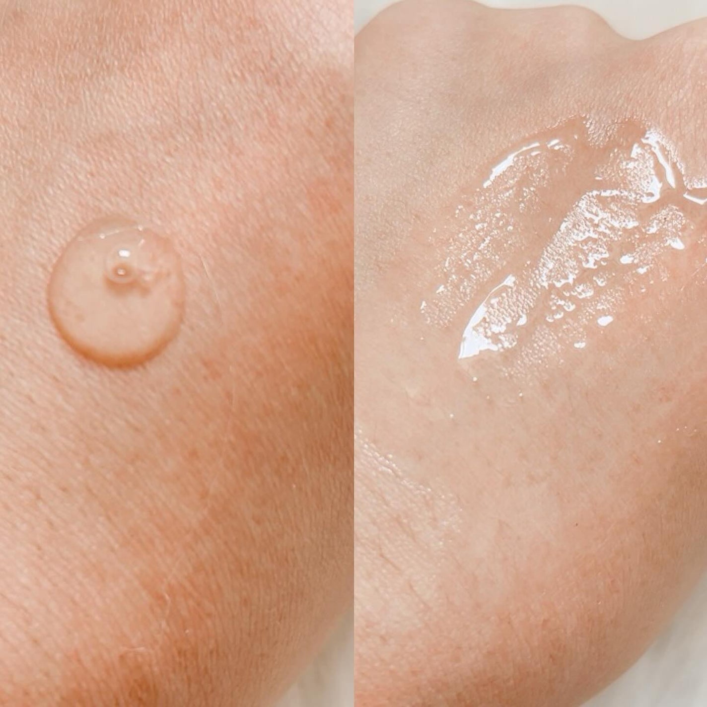 TXトーニングエッセンス1000SHOT/VT/美容液を使ったクチコミ(4枚目)