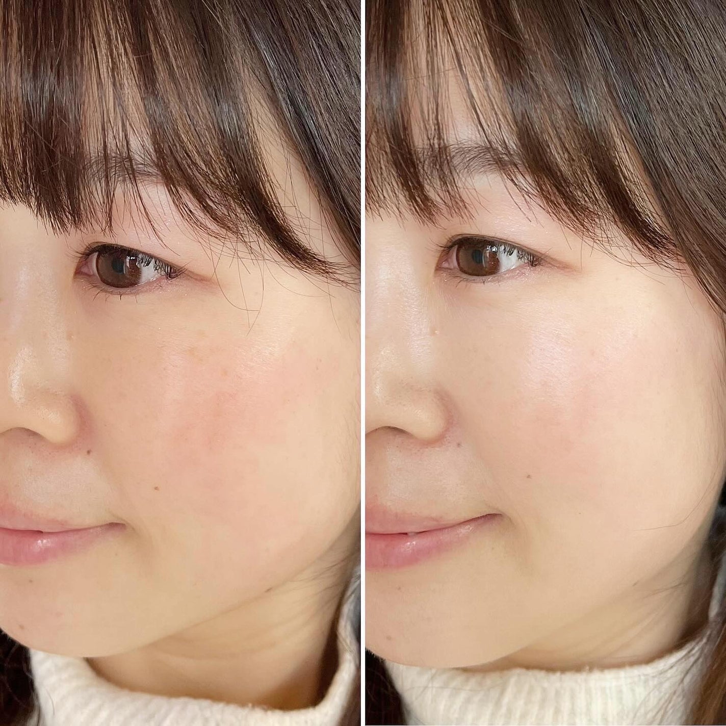 エッセンス スキングロウ ファンデーション/SHISEIDO/リキッドファンデーションを使ったクチコミ(4枚目)