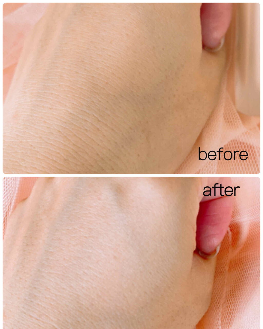 タンイドル ウルトラ ウェア リキッド/LANCOME/リキッドファンデーションを使ったクチコミ（2枚目）