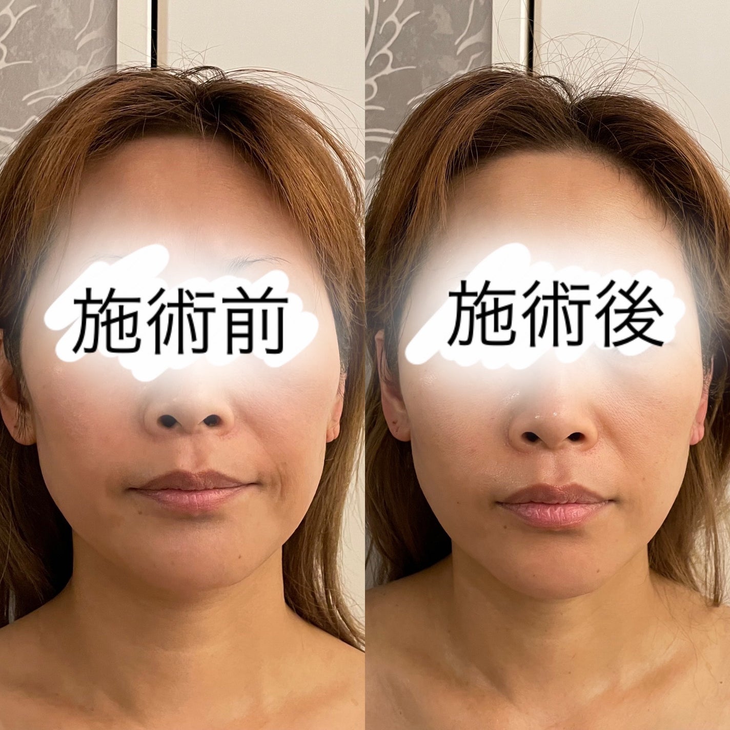 ちゃんまぃ on LIPS 「💄💋👄💄💋👄💄💋👄💄💋👄12.28プライベートサロン甘雨-ka..」(10枚目)