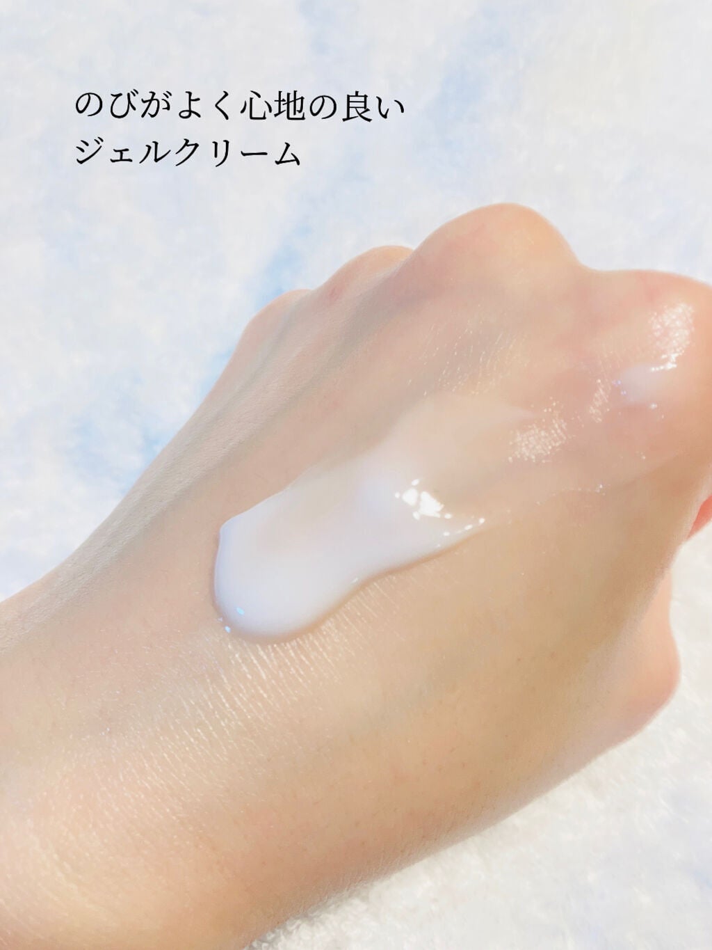 モイスチュア ローション/カルテHD/化粧水を使ったクチコミ(5枚目)