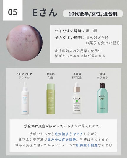 白湯(サユ) | ニキビと戦うOL🤍 on LIPS 「いよいよこの企画が始動🫣!!私もめちゃくちゃ楽しみにしてたフ..」(7枚目)