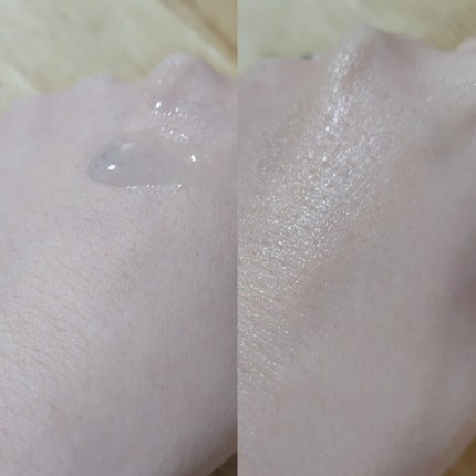 ニードルセラムAZ/fractionalCC/美容液を使ったクチコミ(4枚目)