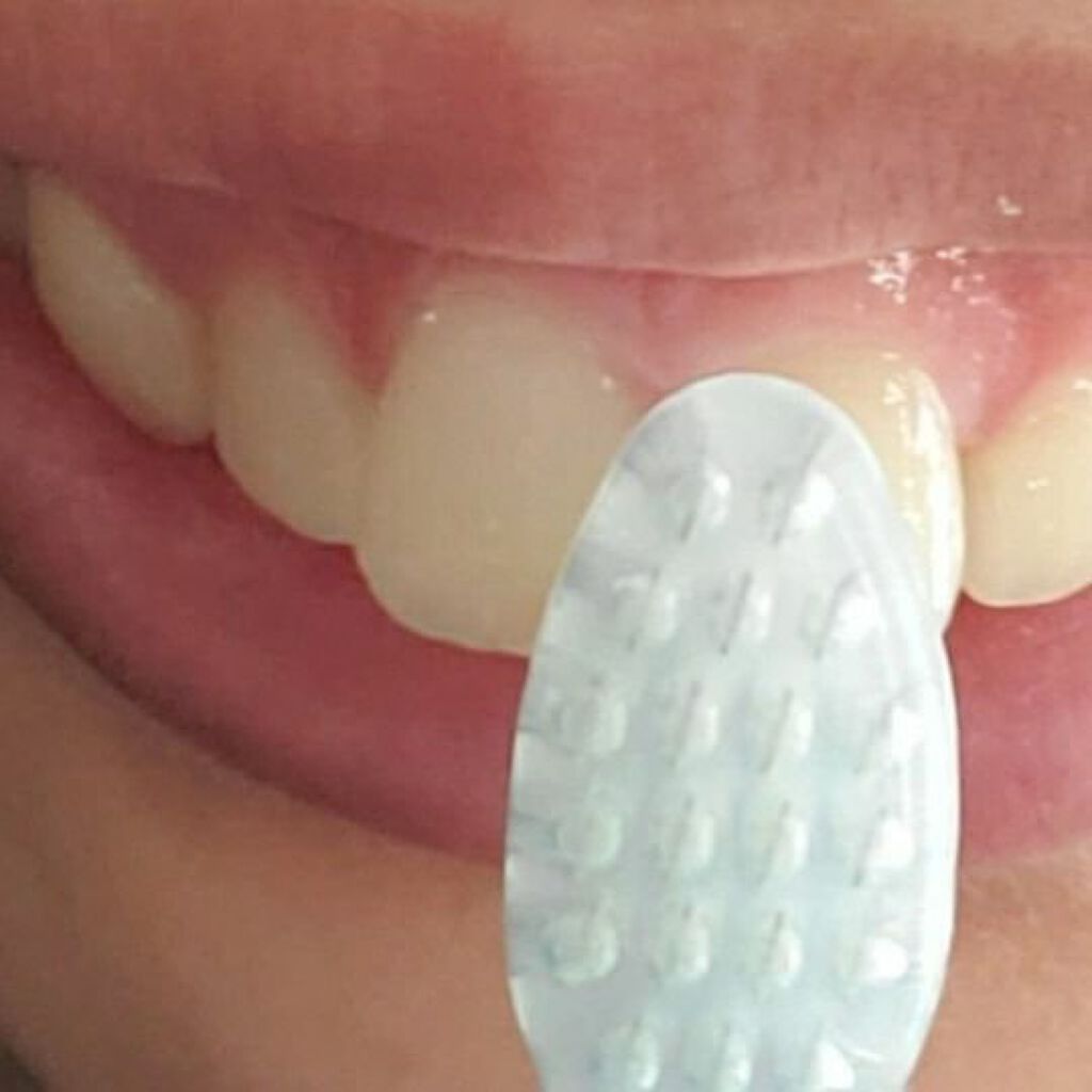 イオン歯ブラシ ionic(アイオニック) 極細レギュラー 本体 ふつう/アイオニック/歯ブラシを使ったクチコミ（2枚目）