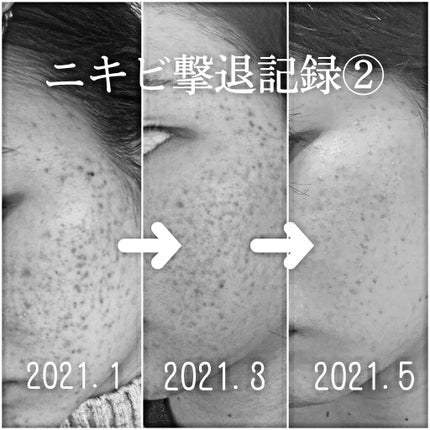 ハトムギ化粧水(ナチュリエ スキンコンディショナー R )/ナチュリエ/化粧水を使ったクチコミ(2枚目)