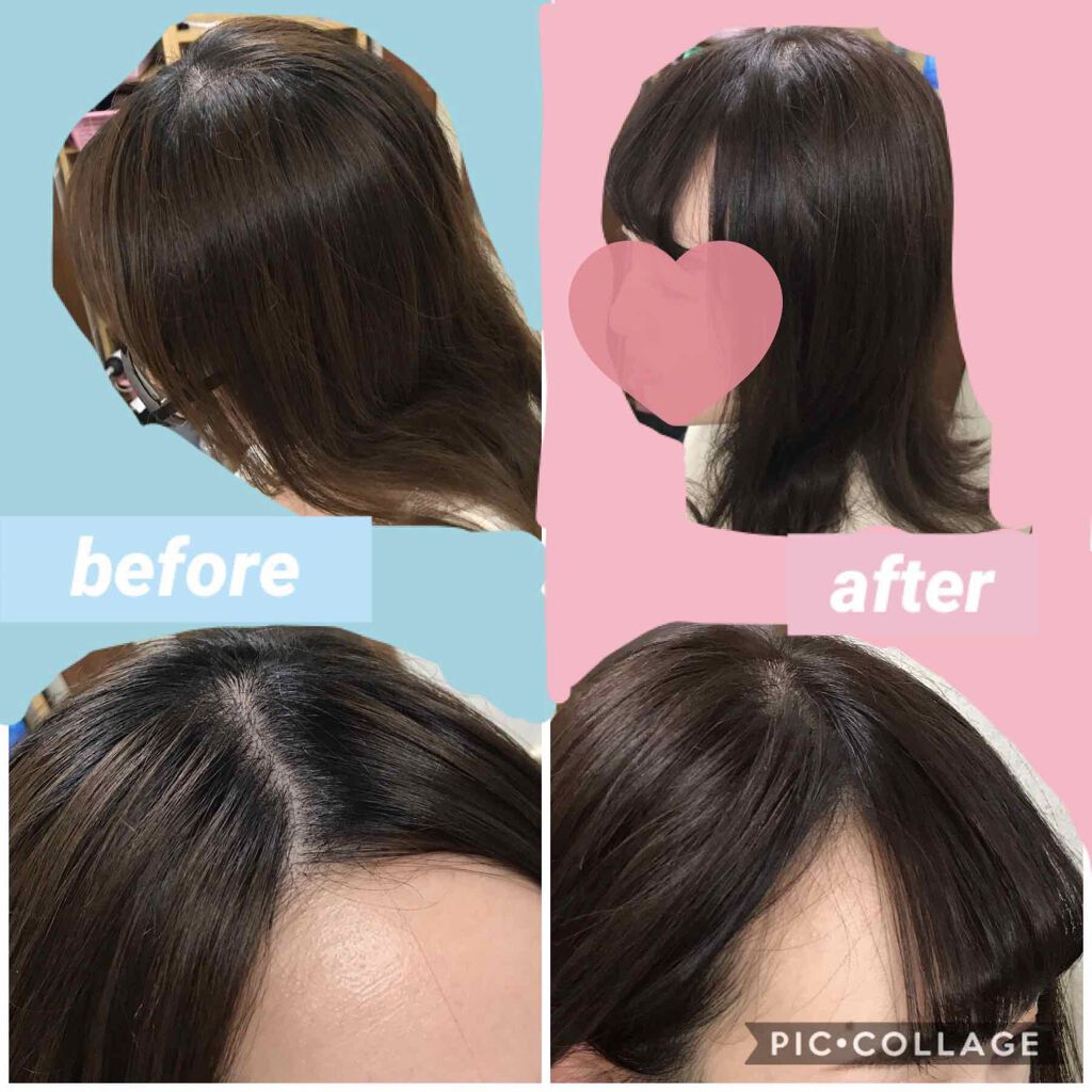 ホイップヘアカラー/ビューティラボ/ヘアカラーを使ったクチコミ（3枚目）