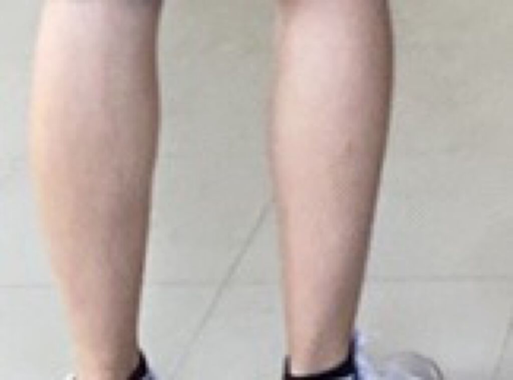 白潤 薬用美白化粧水/肌ラボ/化粧水を使ったクチコミ（3枚目）