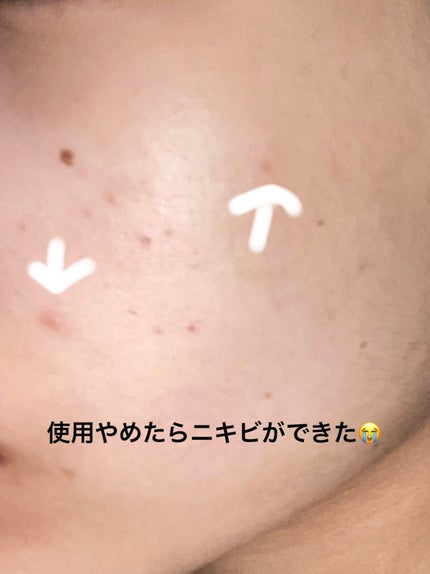 マデカソ CICA化粧水/A’pieu/化粧水を使ったクチコミ(3枚目)