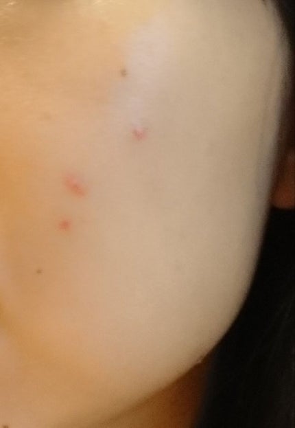 イハダ 薬用バーム【医薬部外品】/IHADA/フェイスバームを使ったクチコミ(2枚目)