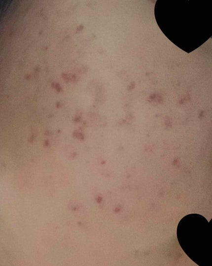 を使ったクチコミ(2枚目)