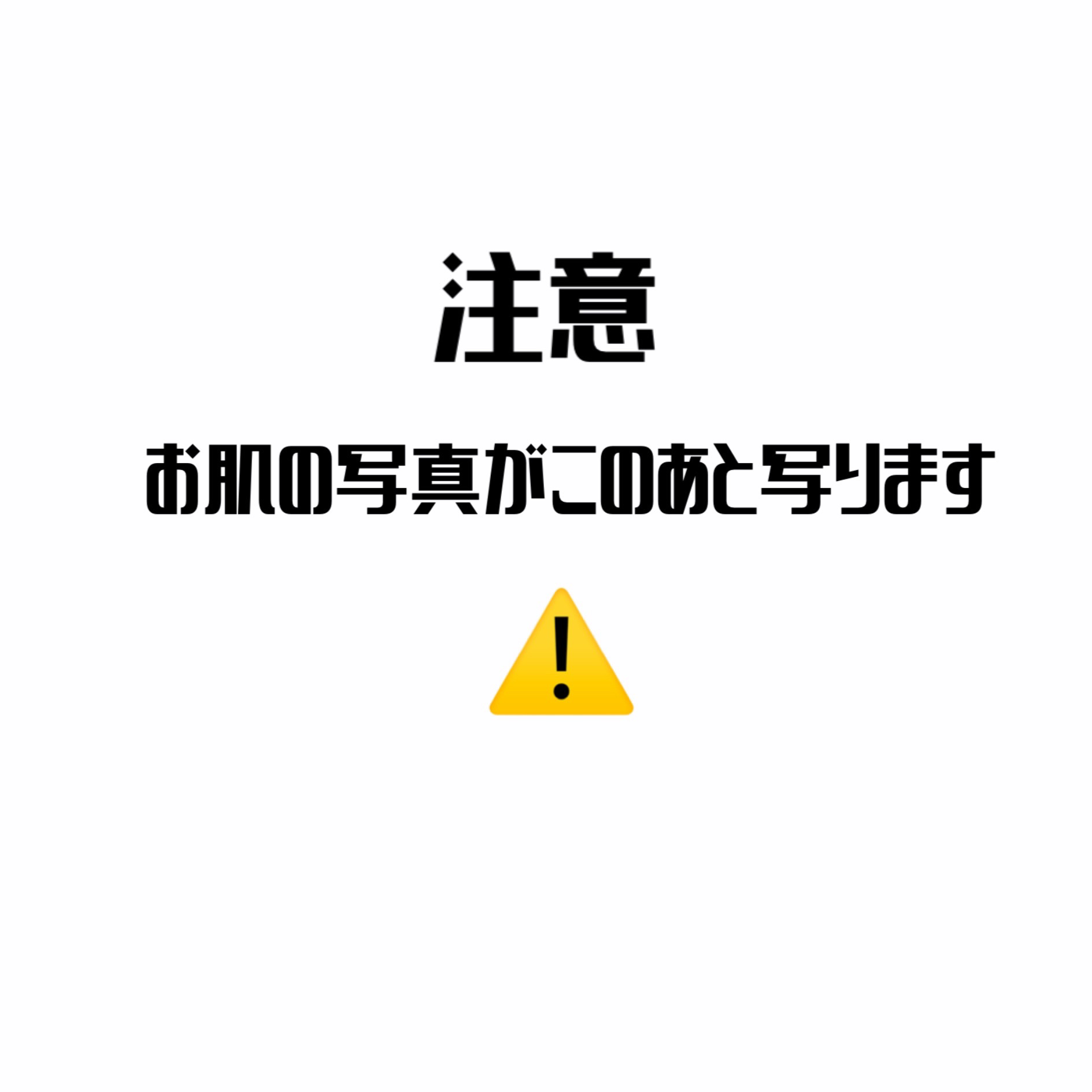 レイヤリングフィット グロークッションEX/TFIT/クッションファンデーションを使ったクチコミ（2枚目）