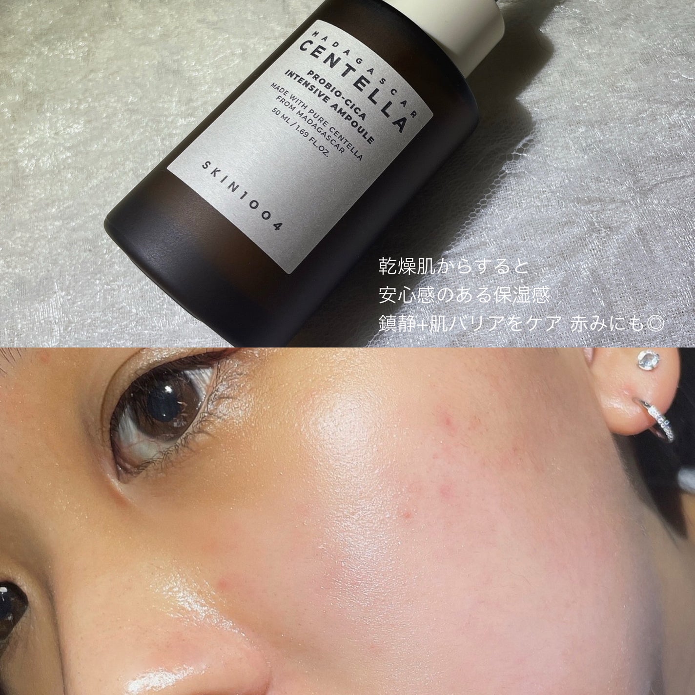 プロバイオシカ インテンシブ アンプル/SKIN1004/美容液を使ったクチコミ(4枚目)