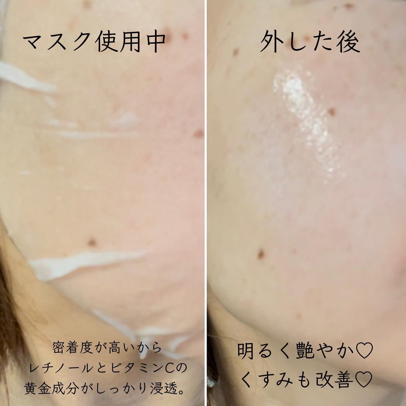 キューブマスク プロポリス/ネイチャーリパブリック/シートマスク・パックを使ったクチコミ(4枚目)