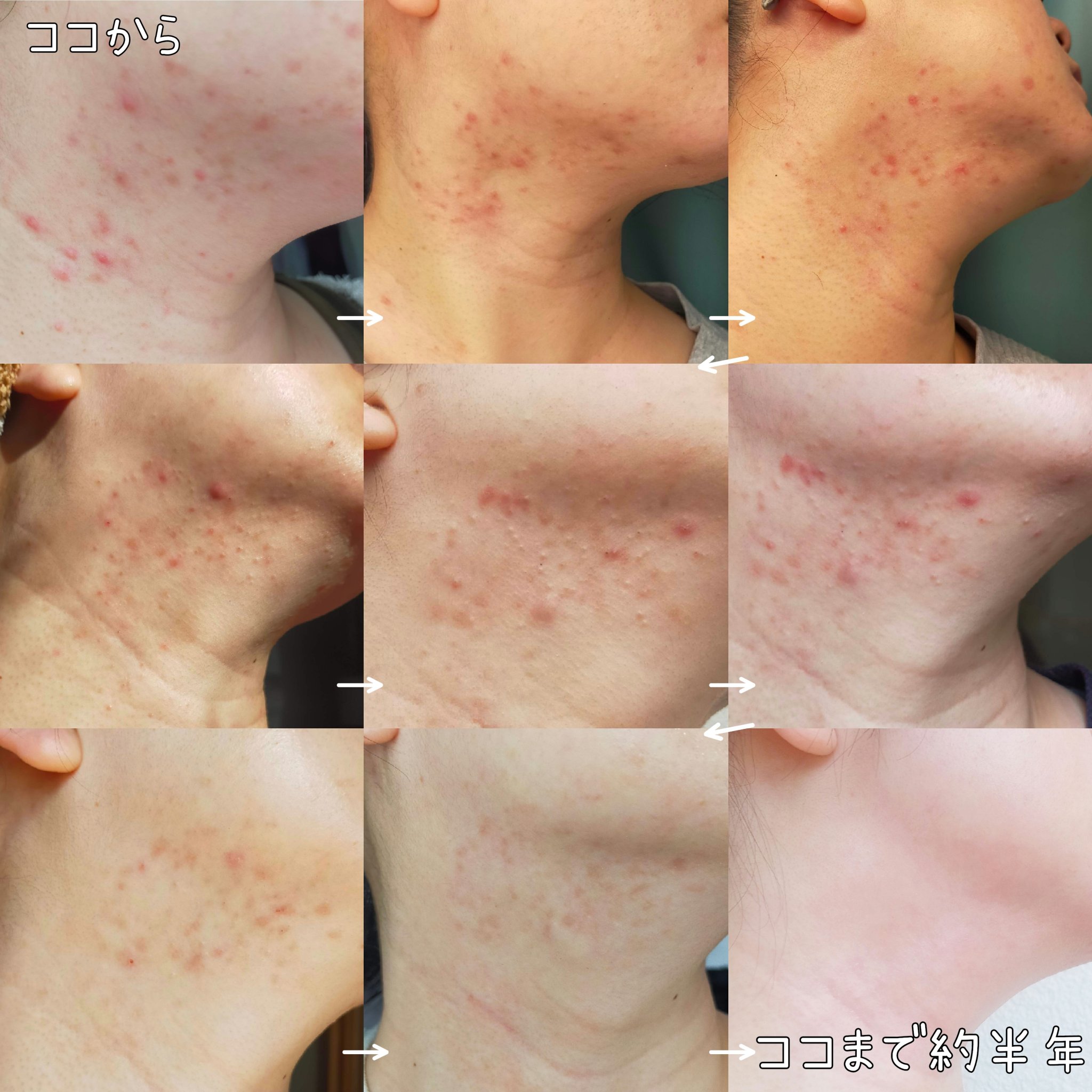 赤箱 (しっとり)/カウブランド/洗顔石鹸を使ったクチコミ（3枚目）