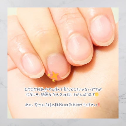 ðãšã ð on LIPS ãããã°ãã¯ãemupanã§ãðâšä»åã¯ã³ã¹ã¡ã¬ãã¥ãŒã§ã¯ãªãã..ãïŒ6æç®ïŒ