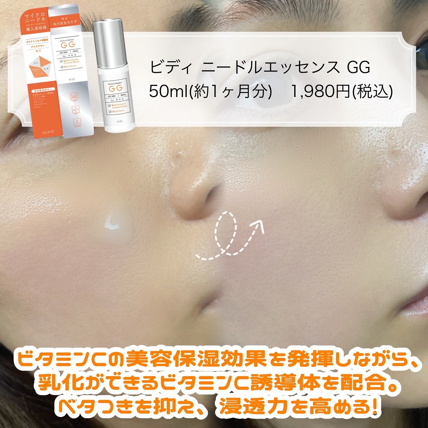 ビディ ニードルエッセンス GG/ビディ/美容液を使ったクチコミ（2枚目）
