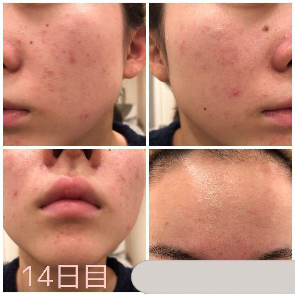 プロP ミスト/CNP Laboratory/ミスト状化粧水を使ったクチコミ（2枚目）