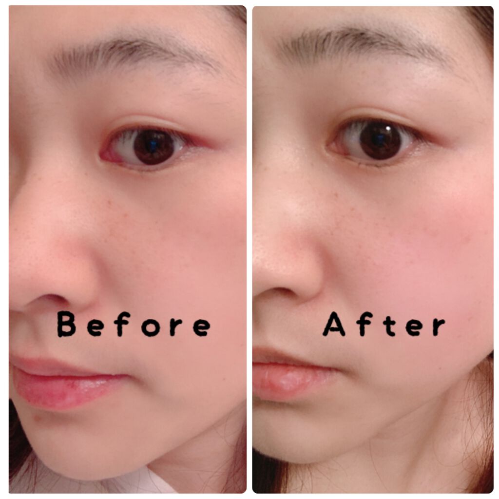 爽快決スパークリングムース/健康サプリの館/美容液を使ったクチコミ(4枚目)