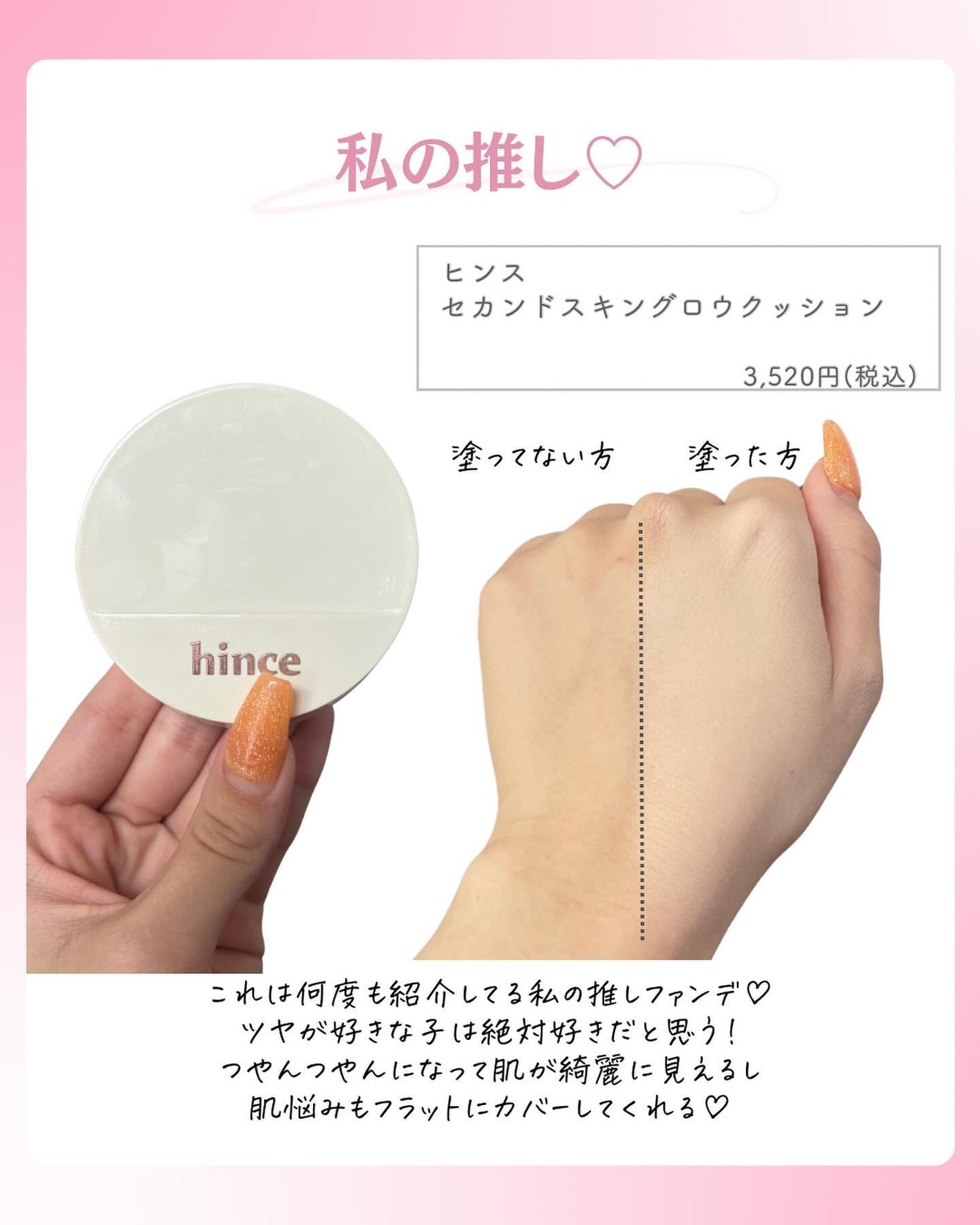 ðºð¬ðµðšðçŸå®¹ã¡ãã£ã¢ on LIPS ã@sena_biyouâïžâïžâïžä»ã®æçš¿ã¯ãã¡ãâšâšãã€ãã..ãïŒ4æç®ïŒ