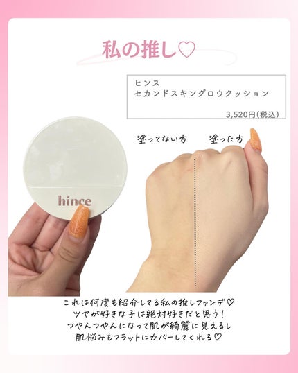 ðºð¬ðµðšðçŸå®¹ã¡ãã£ã¢ on LIPS ã@sena_biyouâïžâïžâïžä»ã®æçš¿ã¯ãã¡ãâšâšãã€ãã..ãïŒ4æç®ïŒ