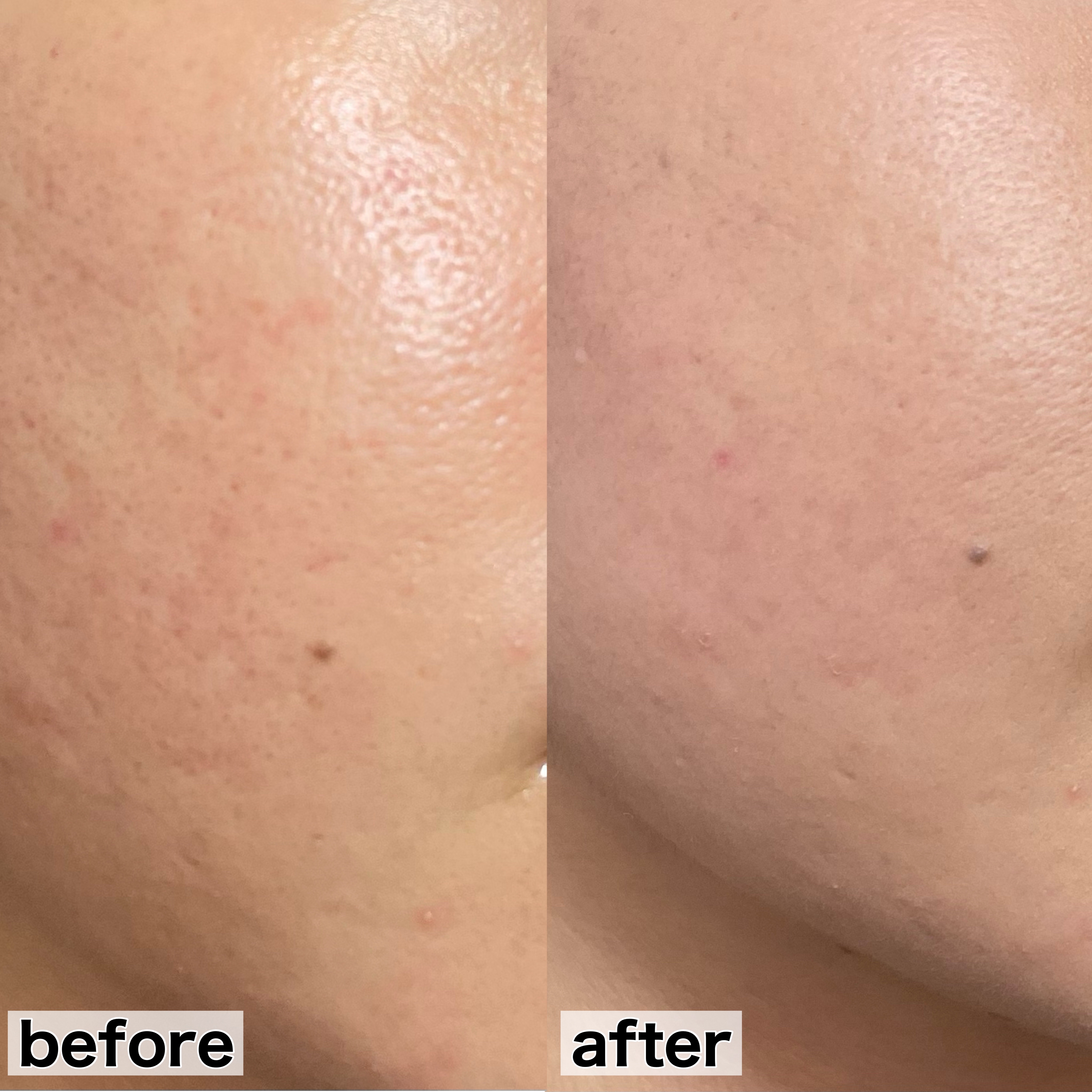 プロフィニッシュファンデーション (ミニ) オークル10/インテグレート/パウダーファンデーションを使ったクチコミ（3枚目）