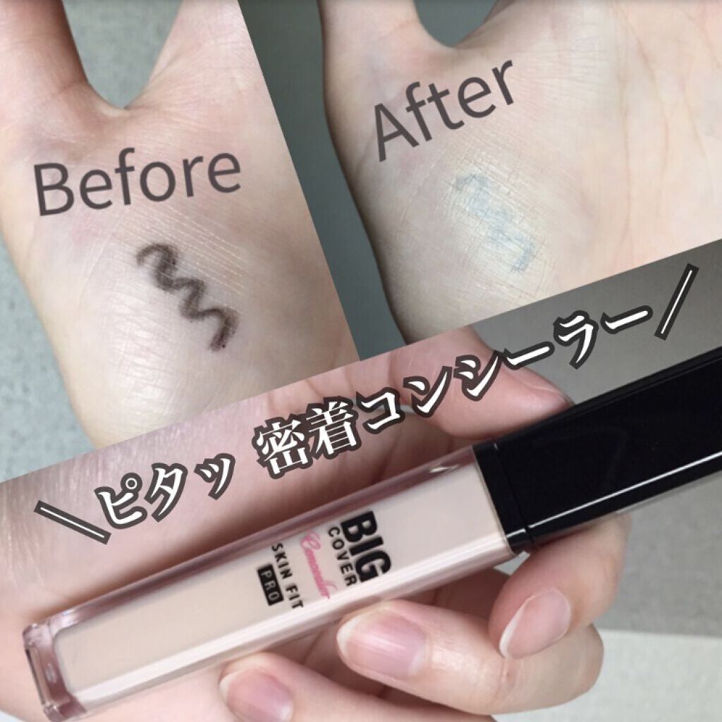ビッグカバーフィットコンシーラー/ETUDE/リキッドコンシーラーを使ったクチコミ（1枚目）