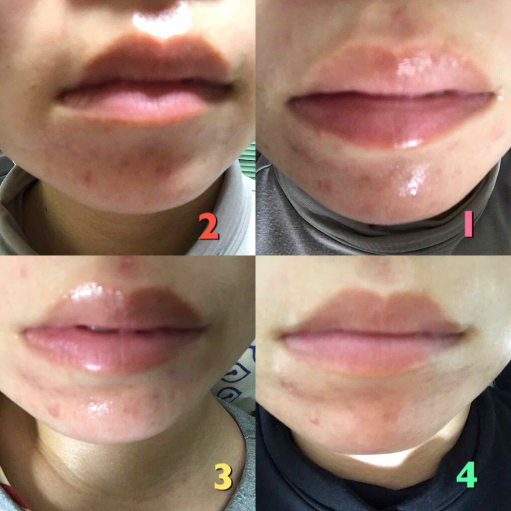 薬用 しみ 集中対策 美容液/メラノCC/美容液を使ったクチコミ(3枚目)