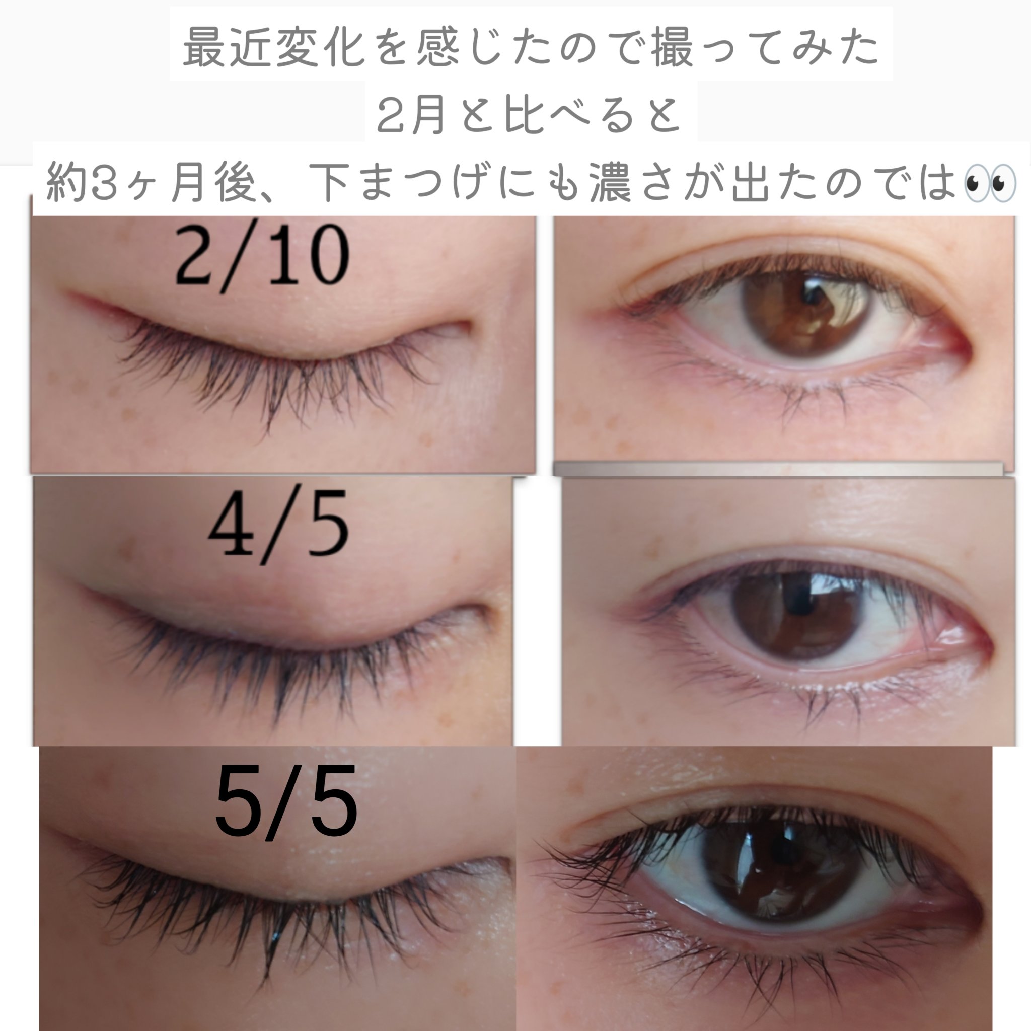 ラッシュアディクト アイラッシュコンディショニングセラム/soaddicted/まつげ美容液を使ったクチコミ（2枚目）