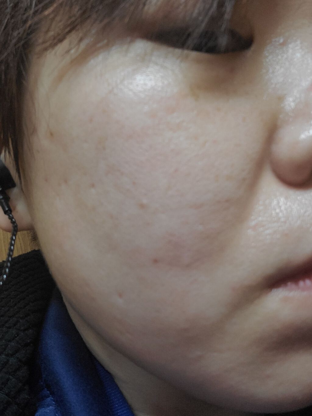 ヒルマイルドクリーム(医薬品)/健栄製薬/その他を使ったクチコミ(1枚目)