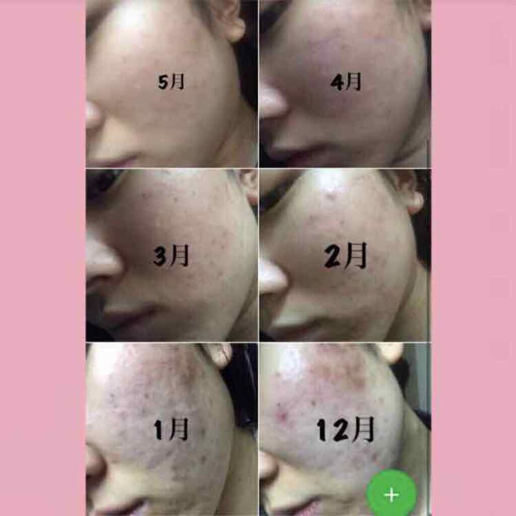 ミノン アミノモイスト モイストチャージ ローションII もっとしっとりタイプ/ミノン/化粧水を使ったクチコミ(2枚目)