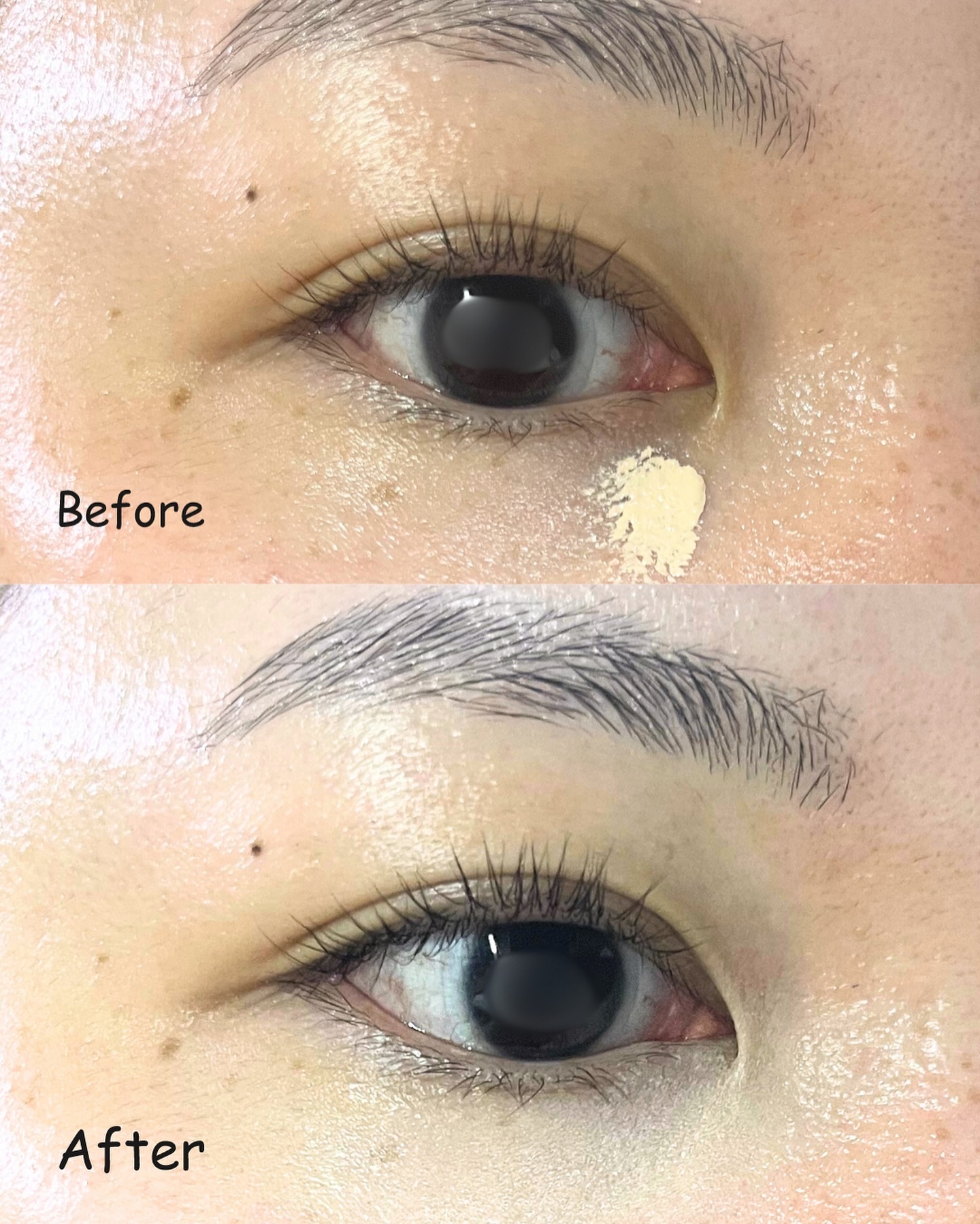 ダーマシンコンシーラー/23years old/リキッドコンシーラーを使ったクチコミ（2枚目）