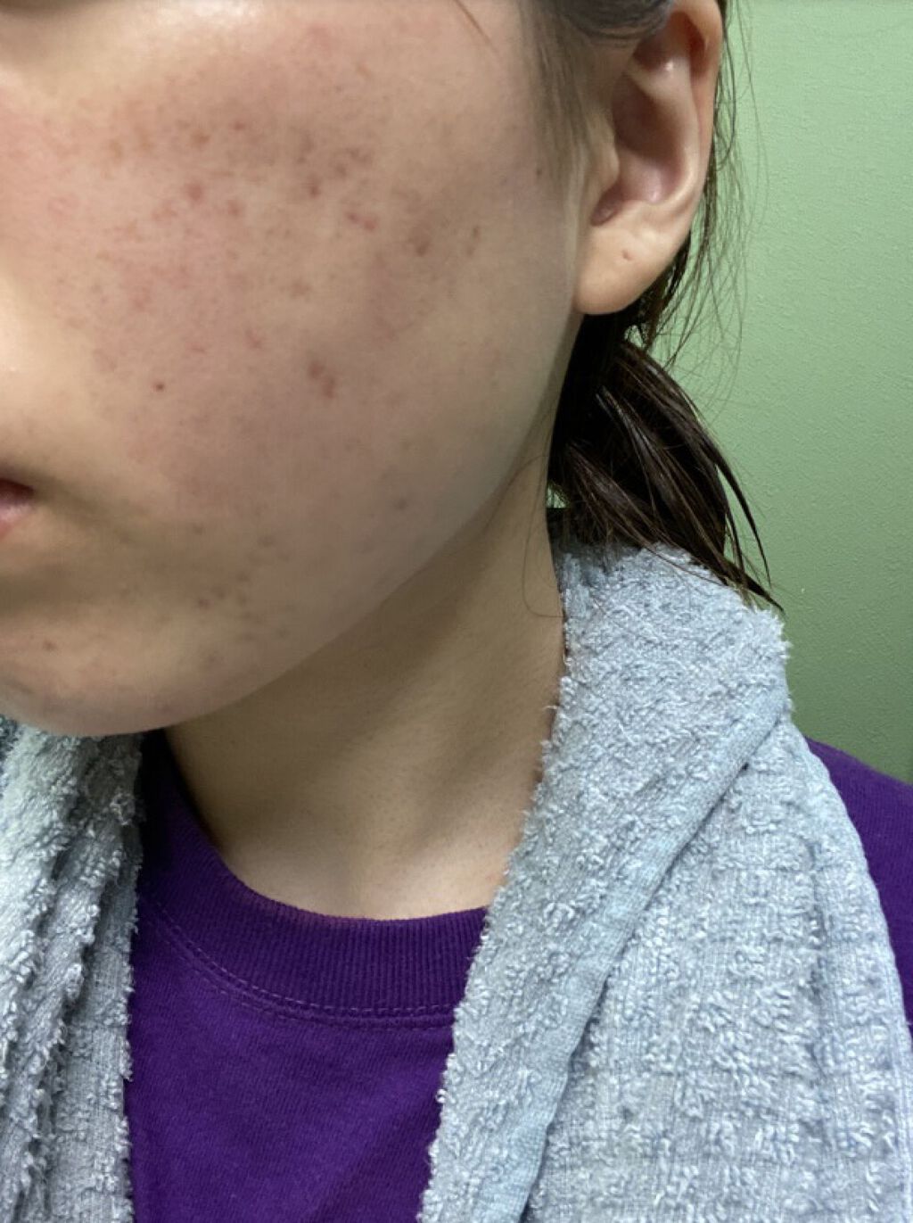 ブライト＆バウンシングローション（ノーマルタイプ）/ジュレリッチ/化粧水を使ったクチコミ（3枚目）