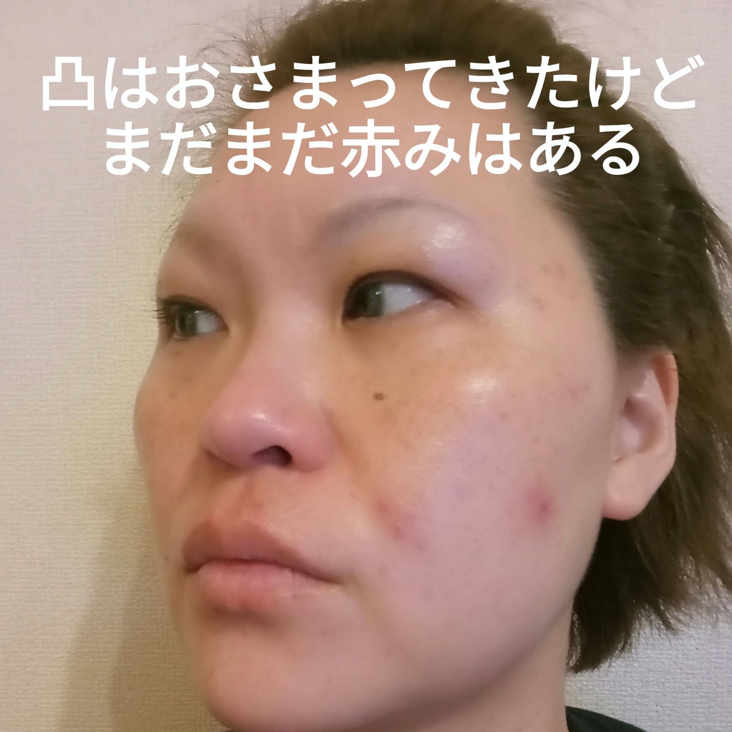 クリアケア化粧水/無印良品/化粧水を使ったクチコミ(3枚目)