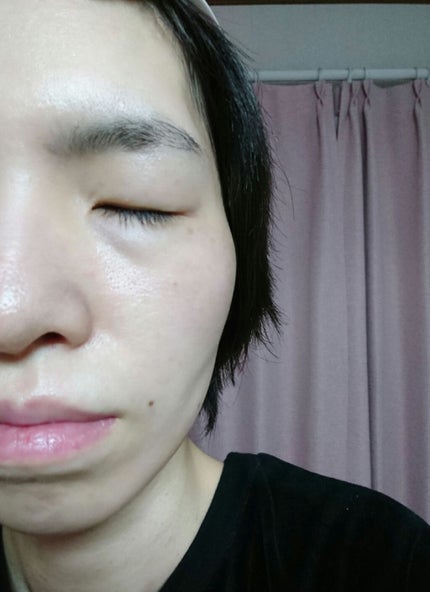 ACコントロールEXディープマスク/DEWYTREE/シートマスク・パックを使ったクチコミ(8枚目)