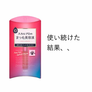 スカルプD
まつ毛美容液



そおいえば
これを使い続けた結果

ずっとまつえくが120くらいしか
つかなかったのに

最近160〜180本は
付くようになりました‼️



これはちゃんと使い続けた