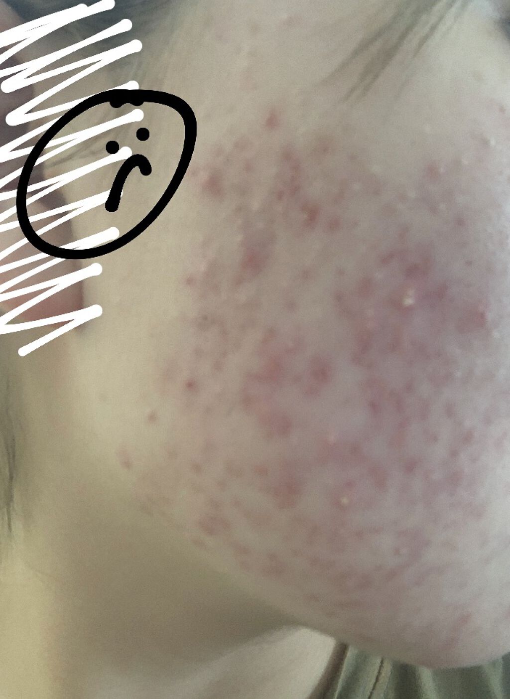 ドクダミ 77 スージングトナー/Anua/化粧水を使ったクチコミ（2枚目）