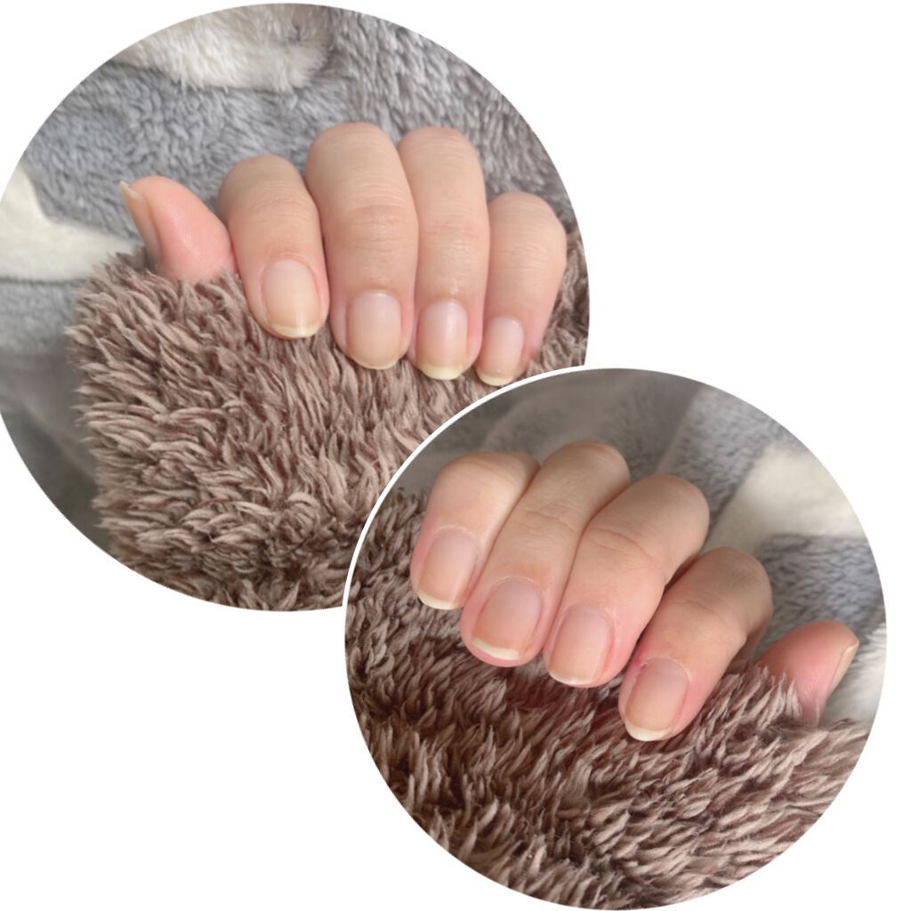 オイルジェルトリートメント/ネイルネイル/ネイルオイル・トリートメントを使ったクチコミ（2枚目）