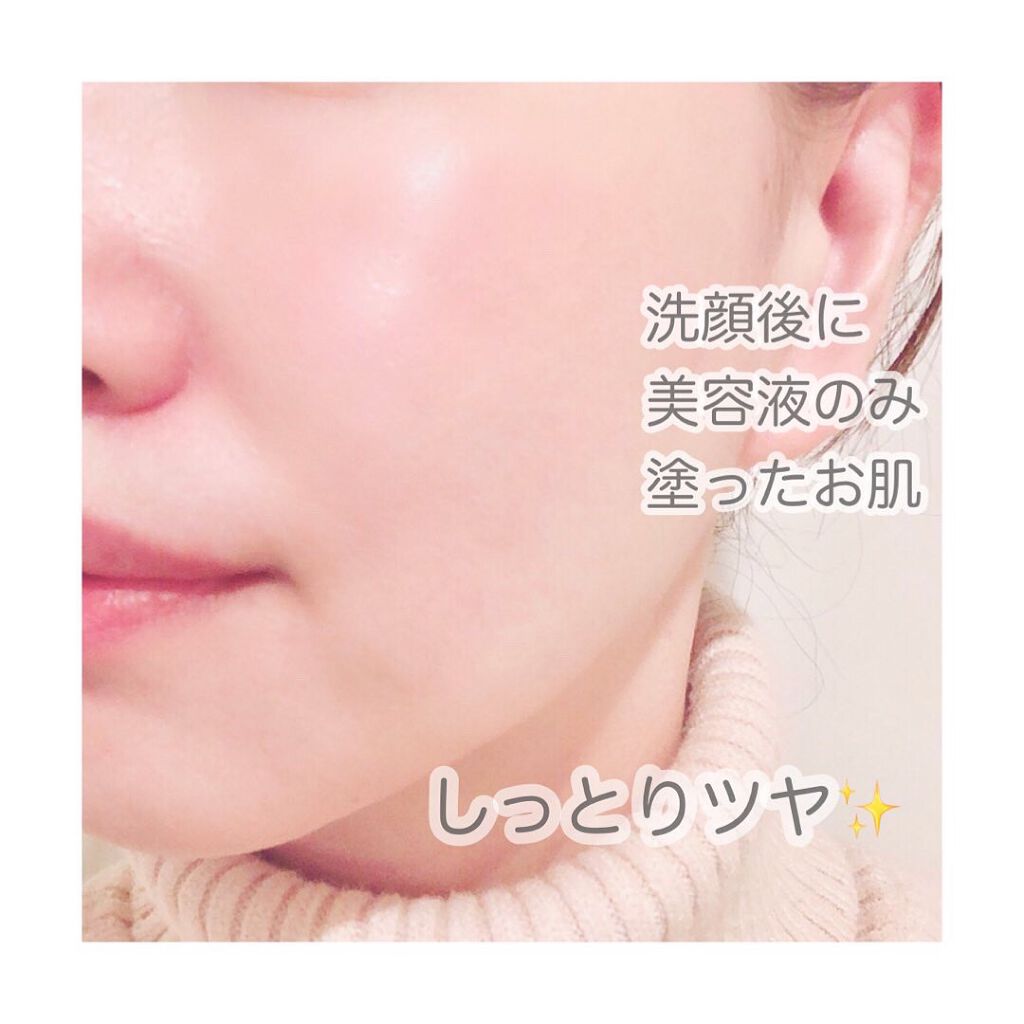 ワクチナイザーV/Re:CODE/美容液を使ったクチコミ（2枚目）