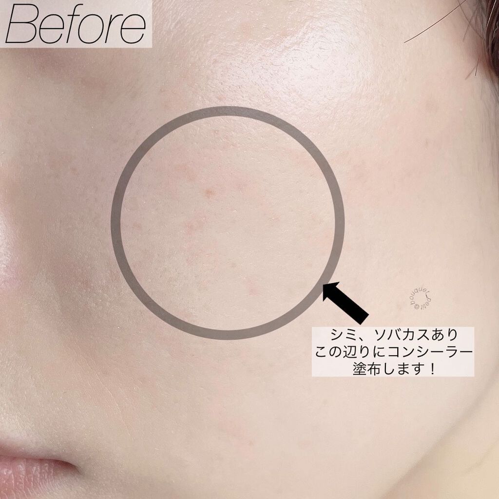 パーフェクトカバー コンシーラーパレット/Dear.A/パレットコンシーラーを使ったクチコミ(6枚目)